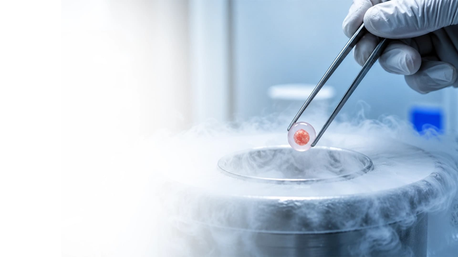Egg freezing and oocyte cryopreservation consultation