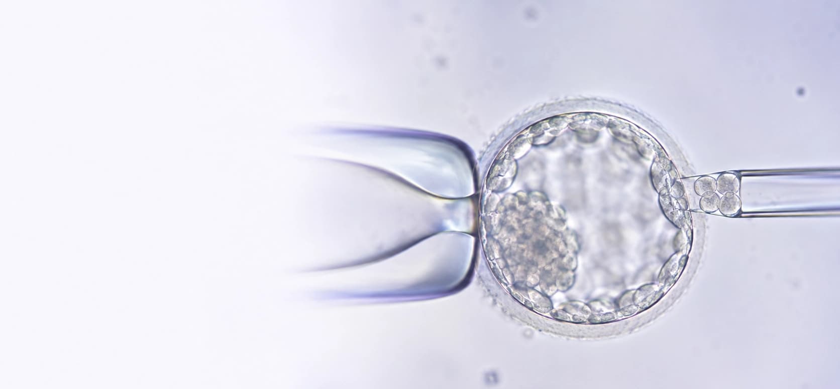 Preimplantation genetic testing in the embryology laboratory