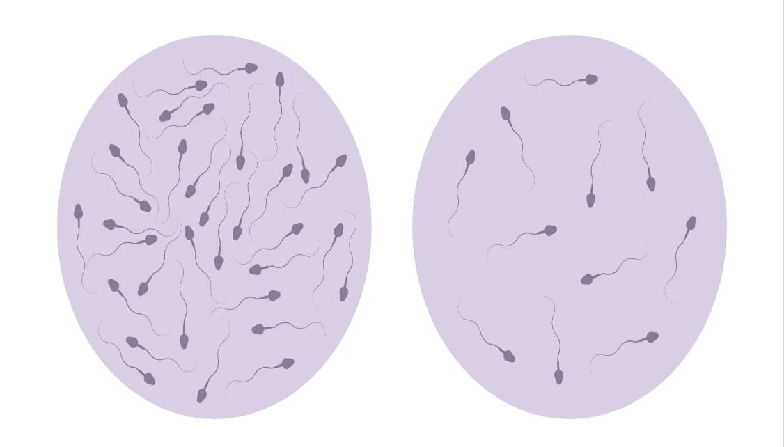 What is the Ideal Sperm Count for Pregnancy?