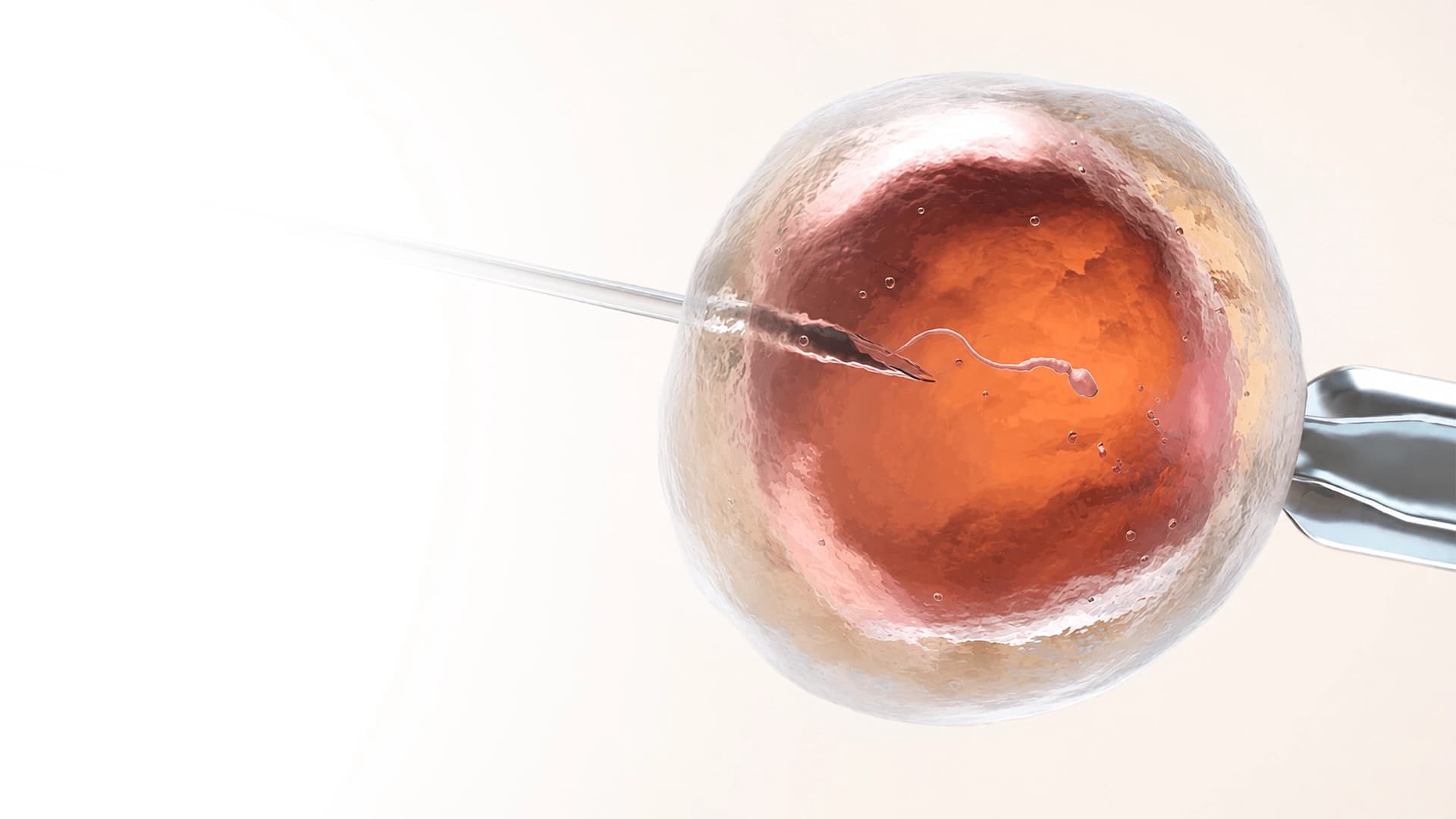 iui
