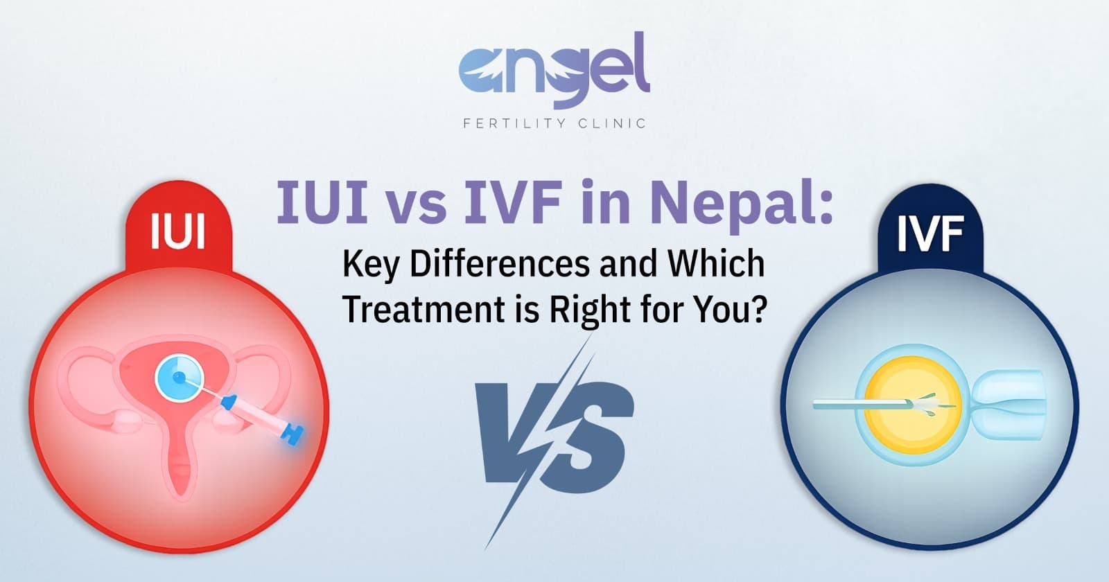 IUI vs IVF in Nepal:  Which Fertility Treatment is Right for You?