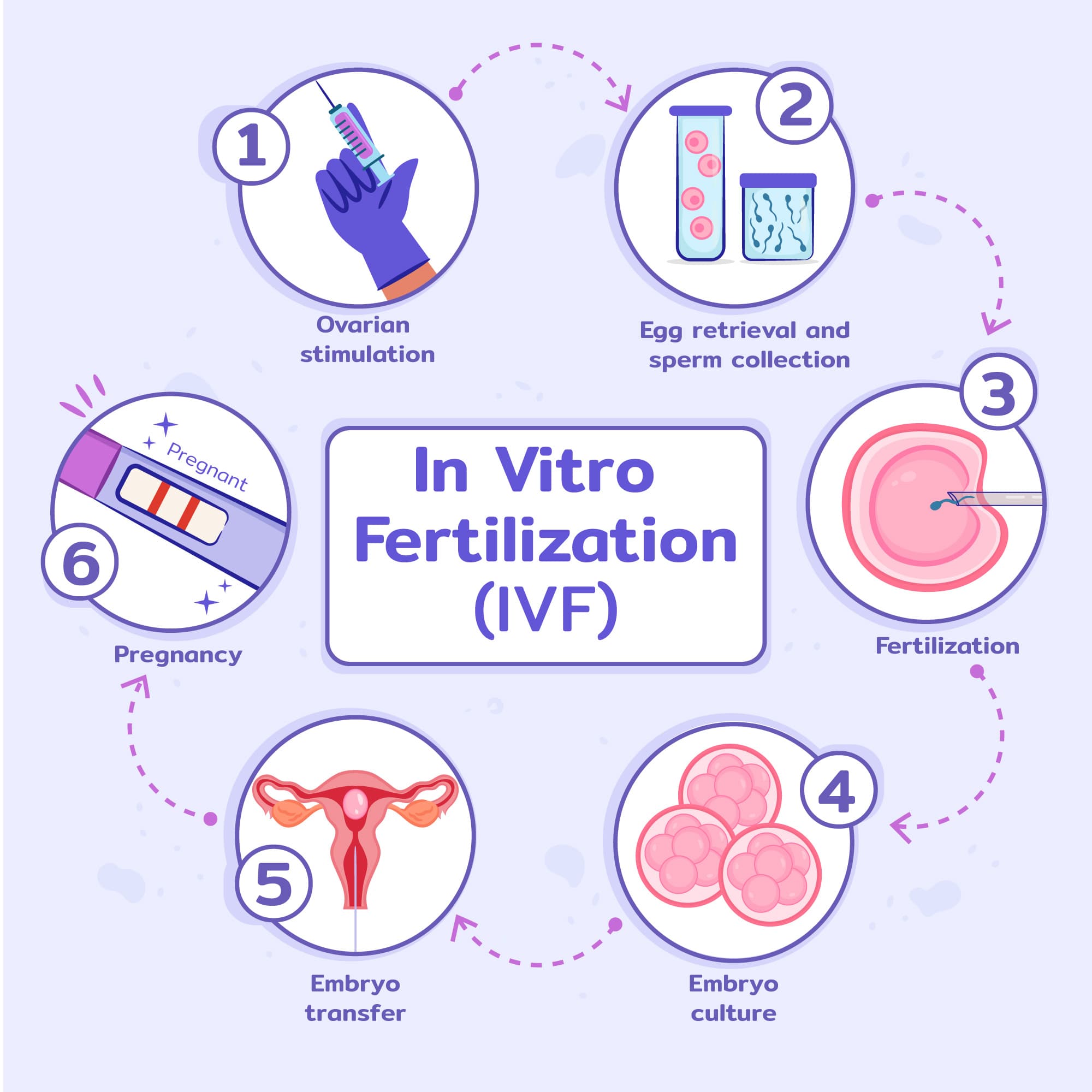ivf