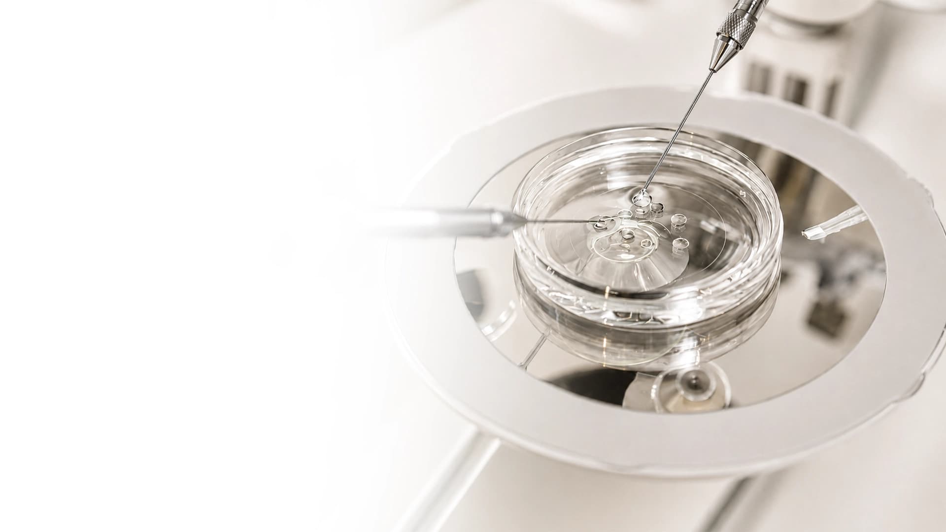 ivf