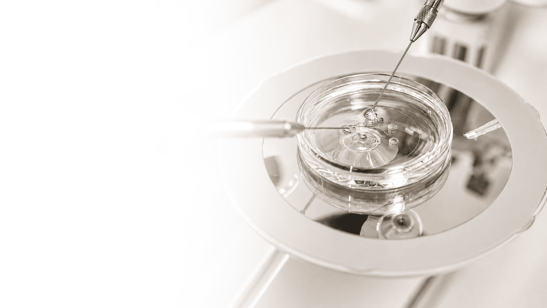 Low AMH IVF consultation